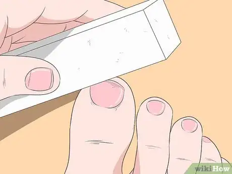 Image intitulée Fix Thick Toenails Step 10
