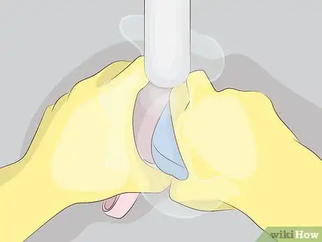 Image intitulée Cure Onycholysis Step 14