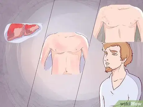 Image intitulée Differentiate Between Malaria, Dengue, and Chikungunya Step 21