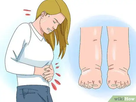 Image intitulée Diagnose Lymphoma Step 4