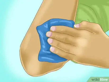 Image intitulée Treat a Skin Flap or Abrasion During First Aid Step 2