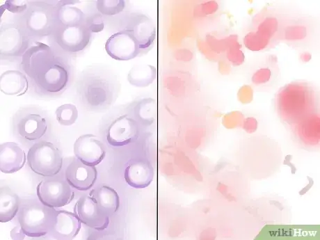 Image intitulée Gram Stain Step 13