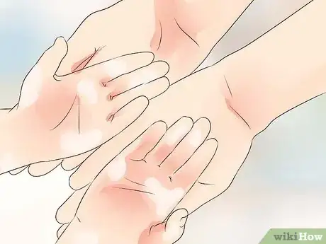 Image intitulée Know if Your Child Has Juvenile Diabetes Step 9