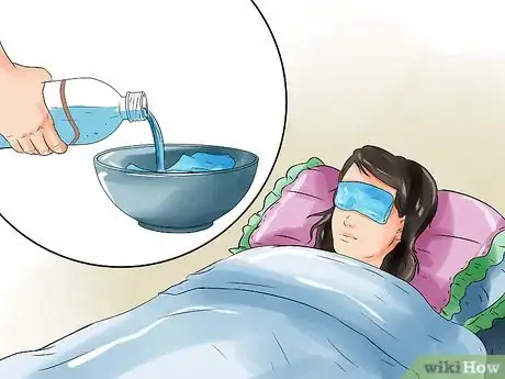 Image intitulée Get Rid of a Stye Step 2