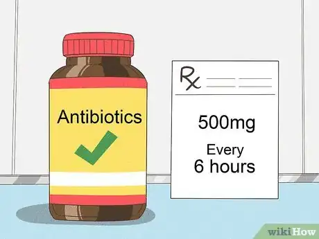 Image intitulée Treat Cellulitis Step 9