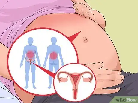 Image intitulée Prevent Incompetent Cervix Step 2