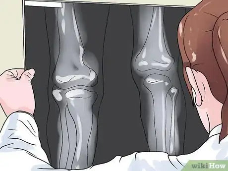 Image intitulée Tell if One Leg Is Shorter Step 17