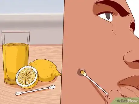 Image intitulée Get Rid of Ingrown Hair Scars Step 1