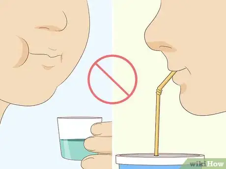 Image intitulée Pull Out a Tooth Without Pain Step 7