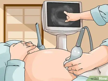 Image intitulée Know the Signs of Miscarriage Step 6