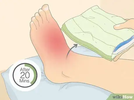 Image intitulée Ice an Injury Step 10