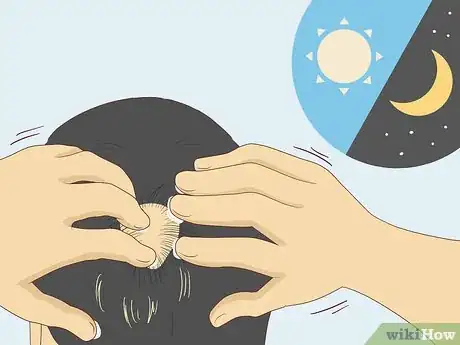 Image intitulée Use Minoxidil (Rogaine) Step 6