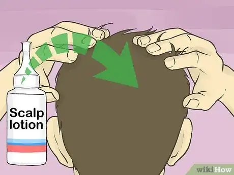 Image intitulée Prevent Dry Scalp Step 7