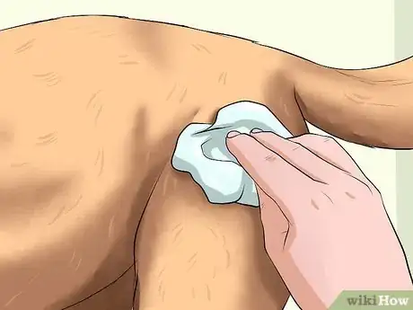 Image intitulée Clean a Dog's Wound Step 8