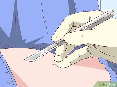 Image intitulée Recover from Typhoid Fever Step 4