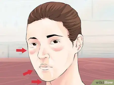 Image intitulée Prevent Lymphedema Step 21