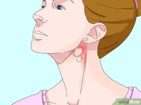 Image intitulée Diagnose Lymphoma Step 1