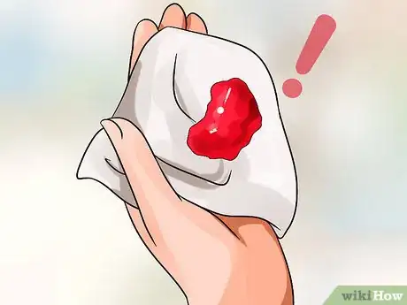 Image intitulée Know the Signs of Miscarriage Step 2