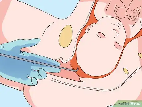 Image intitulée Induce Labor at Home Step 29