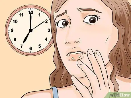 Image intitulée Recognize Herpes Step 3