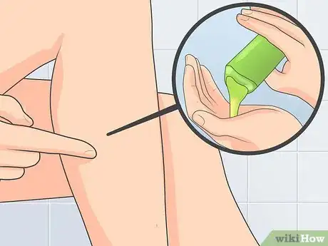 Image intitulée Naturally Stop Granuloma Annulare Step 4