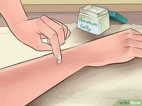 Image intitulée Heal from a Skin Biopsy Step 14