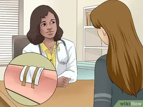 Image intitulée Heal from a Skin Biopsy Step 11