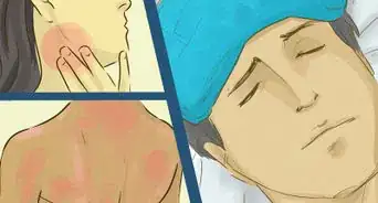 traiter une brulure chimique