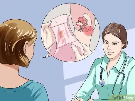 Image intitulée Recognize Chlamydia Symptoms (for Women) Step 4