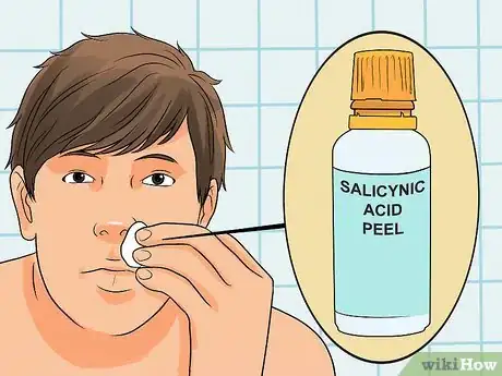 Image intitulée Remove a Raised Mole Step 6