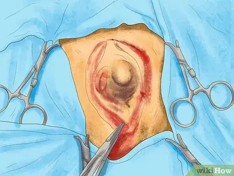 Image intitulée Identify Lumps on Your Cat Step 7