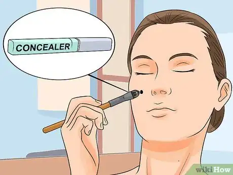 Image intitulée Remove a Raised Mole Step 11