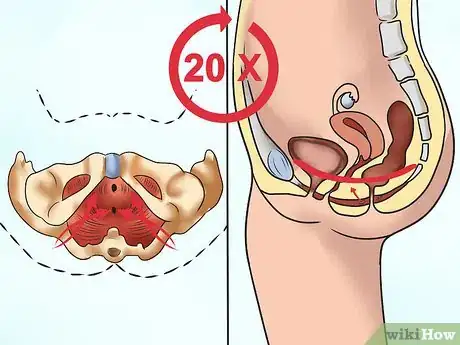 Image intitulée Do PC Muscle Exercises Step 2