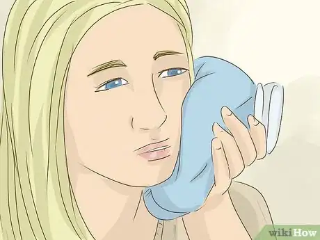 Image intitulée Recover after Wisdom Teeth Surgery Step 11