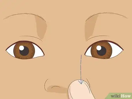 Image intitulée Clear a Blocked Tear Duct Step 6