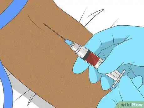 Image intitulée Treat Cellulitis Step 3