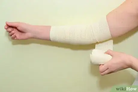 Image intitulée Strap an Elbow Step 5