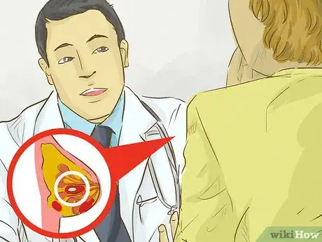 Image intitulée Identify a Lump in a Breast Step 2