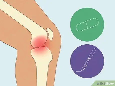 Image intitulée Reduce ESR Step 14