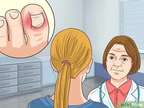 Image intitulée Treat a Torn Toenail Step 12