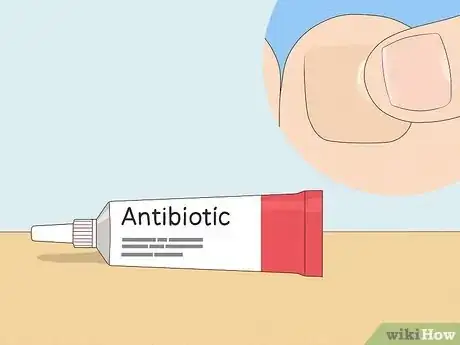 Image intitulée Remove a Dead Toenail Step 14