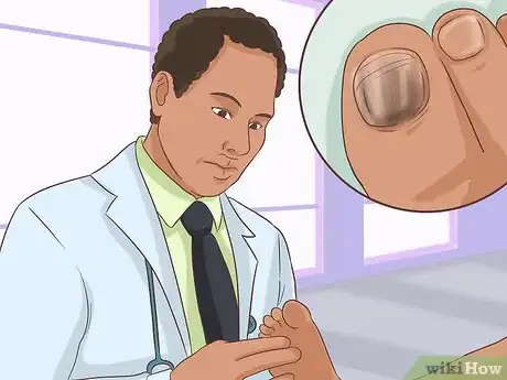 Image intitulée Treat a Torn Toenail Step 13