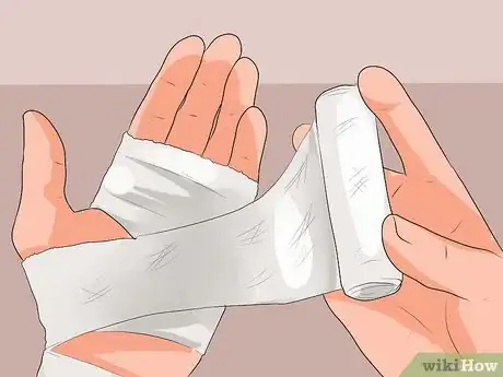 Image intitulée Treat a Hand Burn Step 15