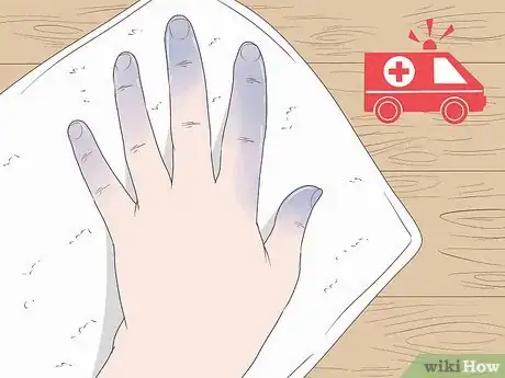 Image intitulée Treat an Ice Burn Step 11