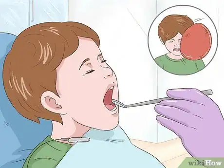 Image intitulée Pull a Loose Tooth at Home Step 13
