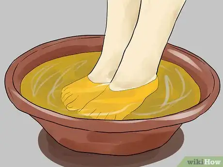 Image intitulée Use Apple Cider Vinegar for Athlete's Foot Step 4