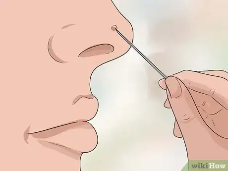 Image intitulée Treat Ingrown Nose Hairs Step 4