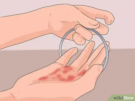 Image intitulée Treat a Hand Burn Step 11
