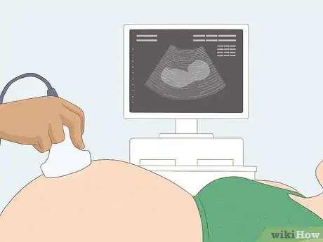 Image intitulée Tell if You're Pregnant with a Girl or Boy Step 17