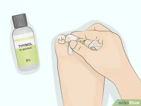 Image intitulée Cure Onycholysis Step 10
